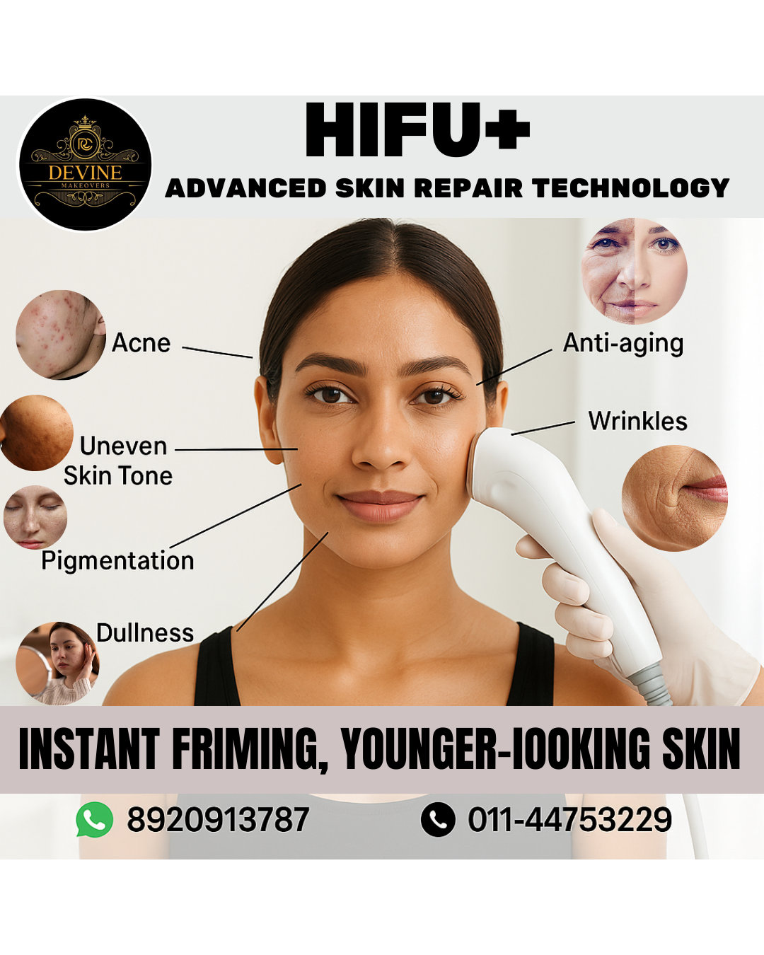 HIFU Advance Face Treatment
