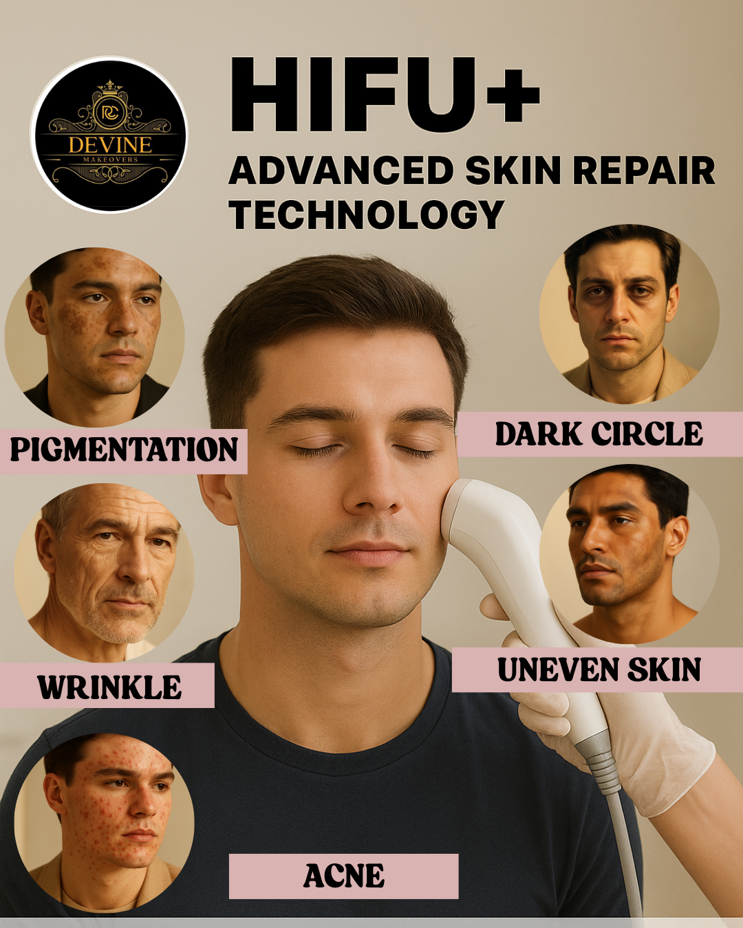 HIFU Advance Face Treatment