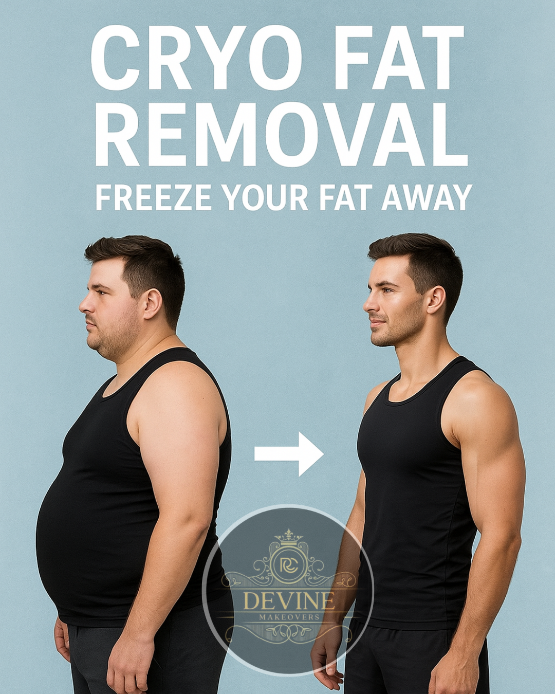 Cryo Fat Removal (CoolSculpting)